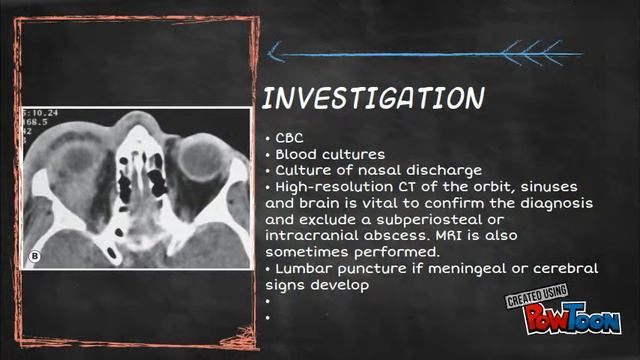 orbital infection смотреть онлайн
