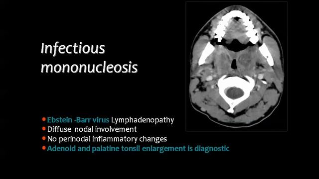 Imaging of Lymphatic system Ib - Prof Dr. Mamdouh Mahfouz (In Arabic) смотреть онлайн