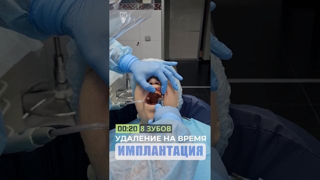 Удаление зубов на время. смотреть онлайн