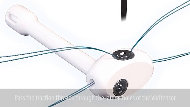 MALE REMEEX SURGERY+ADJUSTMENT смотреть онлайн
