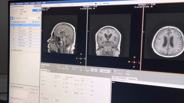 Mri brain смотреть онлайн