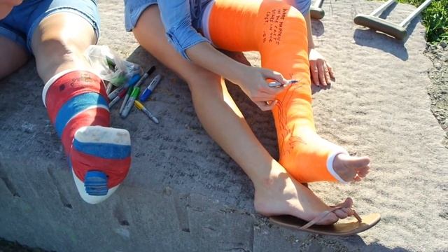 Emily's first leg cast! смотреть онлайн