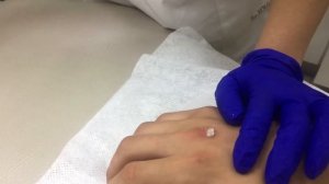 Удаление шипицы