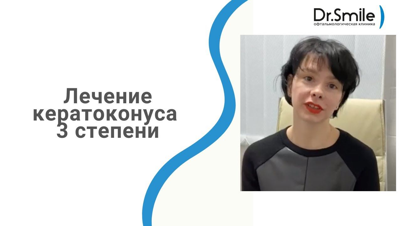 Лечение кератоконуса 3 степени смотреть онлайн