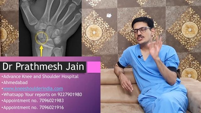 Scaphoid Fracture , All you want to know (Hindi) स्केफोइड फ्रैक्चर смотреть онлайн