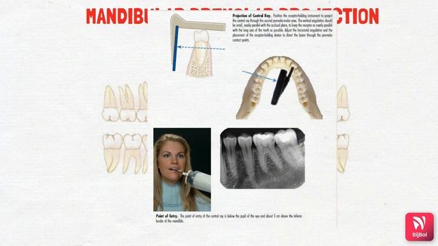 INTRA ORAL RADIOGRAPHIC TECHNIQUES смотреть онлайн