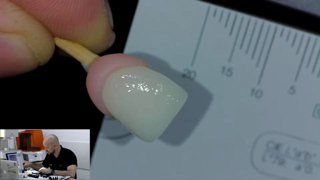 Безкоштовний вебінар "Повноанатомічні безметалеві реставрації" смотреть онлайн