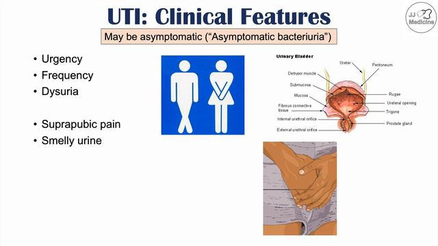 Urinary Tract Infections (UTI) Overview | Causes, Risk Factors, Symptoms, Diagnosis, Treatment