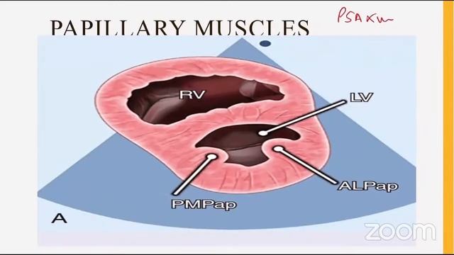 Basics of 2D ECHO смотреть онлайн