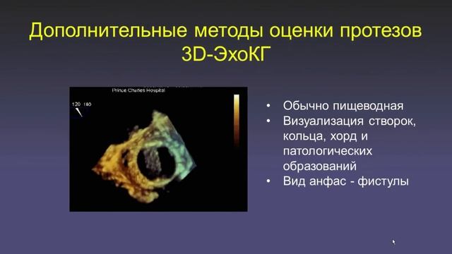 Echo-class.ru / Образовательный сайт по эхокардиографии проф. Л. Л.Берштейна и проф. В.И.Новикова