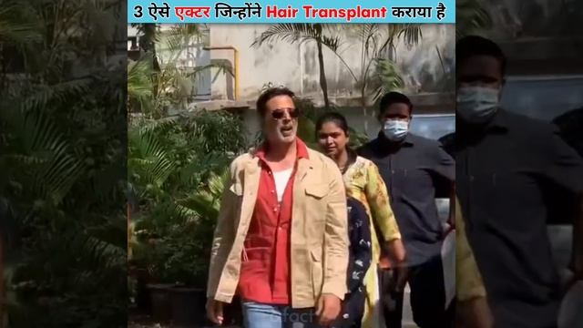 Bollywood के 3 ऐसे अभिनेता, जिन्होंने Hair Transplant करवाया है।
