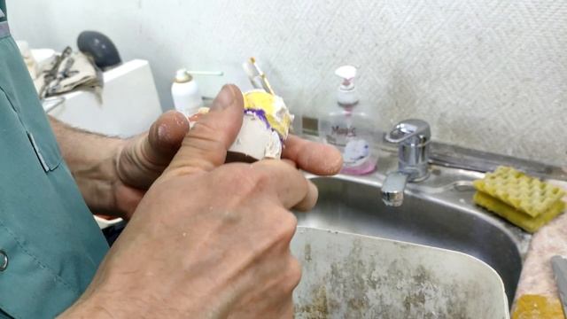 приварка зуба на бюгельный протез часть 1 смотреть онлайн