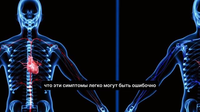 НЕ ИГНОРИРУЙ ЭТО! 10 признаков возможного сердечного приступа смотреть онлайн