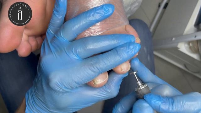 Трещины на пятках. Поднимаем средний чек без увеличения времени. #pedicure #педикюр смотреть онлайн