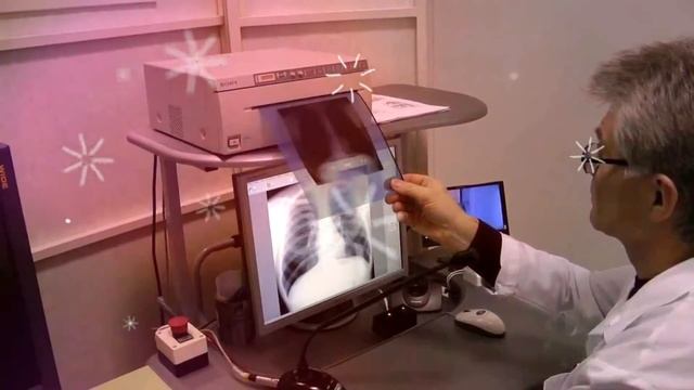 ФЛЮОРОГРАФИЯ ВРЕД! флюорография вредна для здоровья, чем вредна частая флюорография смотреть онлайн
