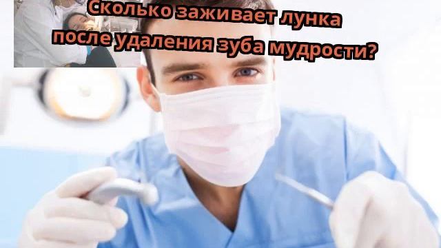 Сколько заживает лунка после удаления зуба мудрости? смотреть онлайн