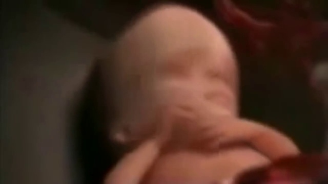 Видео о вреде курения