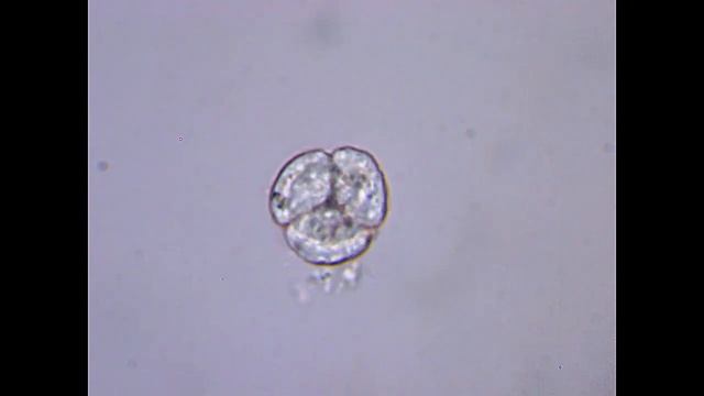 Сразу четыре микроба на свет появились | МИТОЗ - деление, размножение ОДНОКЛЕТОЧНЫХ ПОД МИКРОСКОПОМ смотреть онлайн