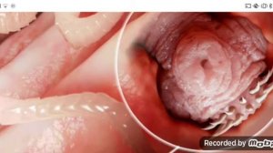 паразиты. 1 Часть. Ленточный червь