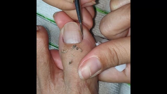 How to Repair Nails easy #201 - Xuyen Nail смотреть онлайн