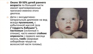 Экссудативно-катаральный диатез