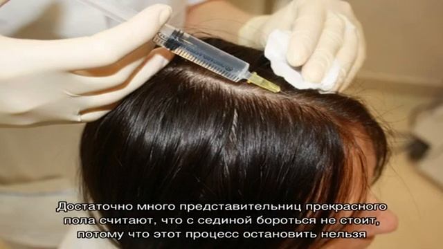 Как бороться с сединой в молодом возрасте?