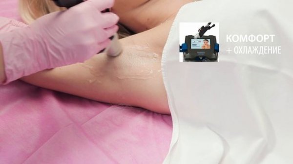 Лазерная эпиляция MOTUS AX с новейшей технологией MOVEO ▷ Клиника Литус ▷ Киев ▷ Лазер DEKA MOTUS AX