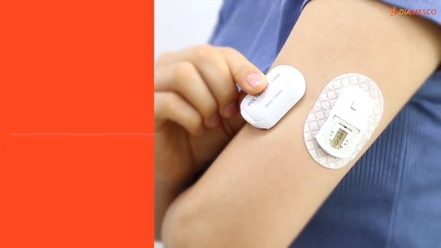POCTech CT-100B. Система мониторинга глюкозы в крови (CGM)