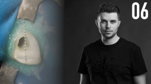 Почему ломаются инструменты? Серия 1: торсионная нагрузка