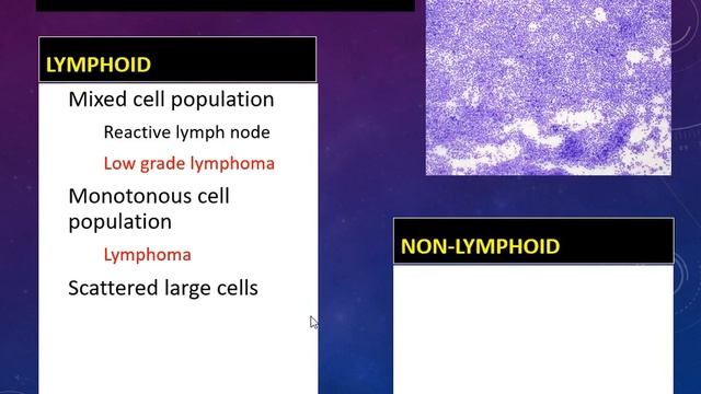 Lymph Node FNA Cytology: Approach смотреть онлайн