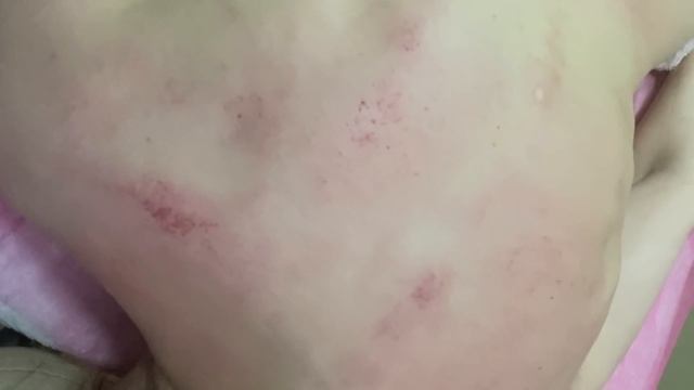 Лицо помолодело, спина в синяках, сон как у младенца! смотреть онлайн