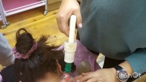 Баночный массаж спины