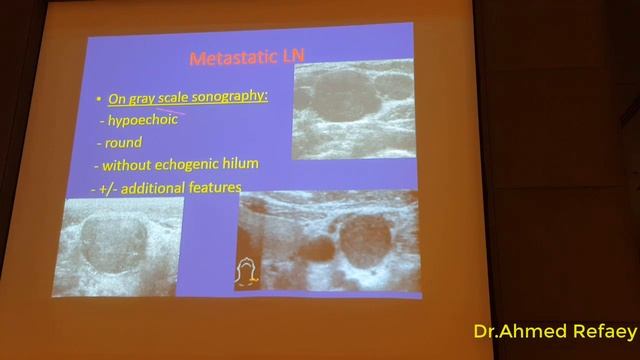 US of neck lymph nodes - Dr. Ahmed Refaey смотреть онлайн
