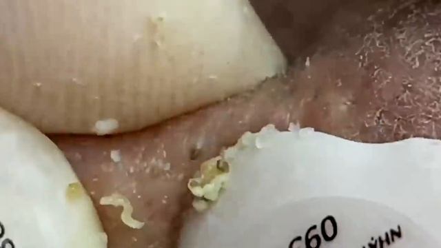 Enjoy Your Day With Hien Nguyen Spa # 1102 смотреть онлайн