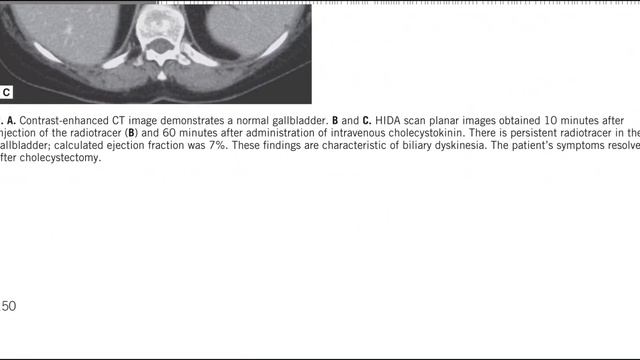 GIT MC GRAW HILL RADIOLOGY BOOKS FRCR(5) смотреть онлайн