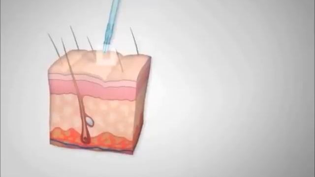 JET CLEAR - Water Jet Peel-Behandlung смотреть онлайн