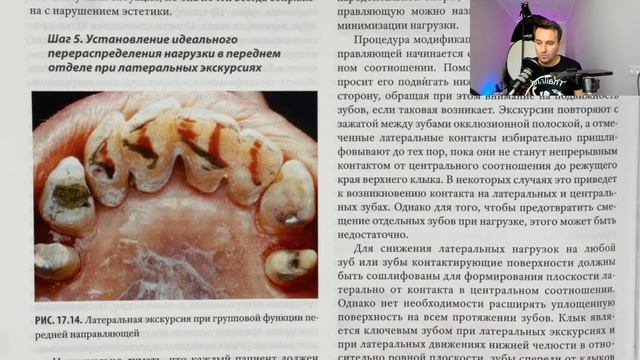 22. Функциональная окклюзия. Питер Доусон смотреть онлайн