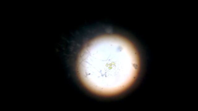 Амёба протей(amoeba Proteus)