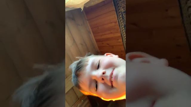 Мои детские травмы коленки смотреть онлайн
