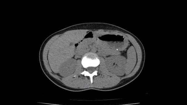 Запись экрана 16 09 2018 7 12 14 смотреть онлайн