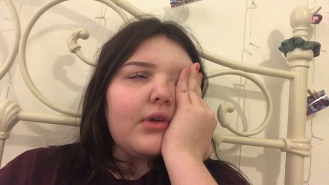 MY EXPERIENCE ON PREDNISOLONE