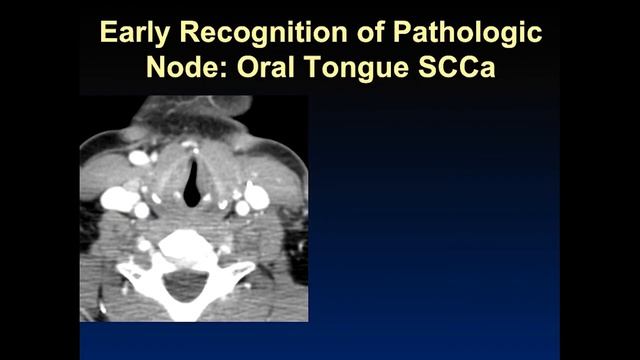 Imaging of Cervical lymphnodes смотреть онлайн
