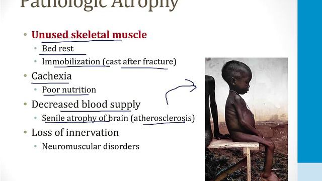 Pathology - 1. General Topics - 1.Cellular Adaptations Atf