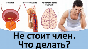 Плохо стоит член.
