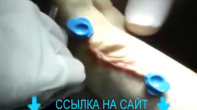 купить валгус про смотреть онлайн