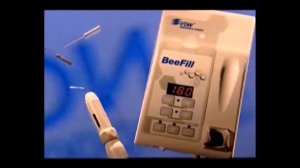 Как пломбировать горячей гуттаперчей (2 часть)