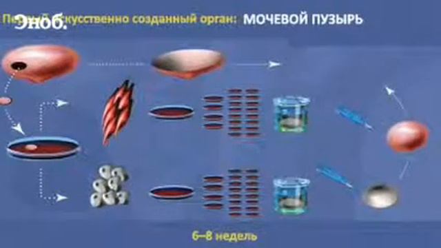 Выращенные органы 1 смотреть онлайн