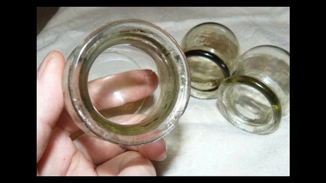 О самом интересном методе лечения: все про банки смотреть онлайн