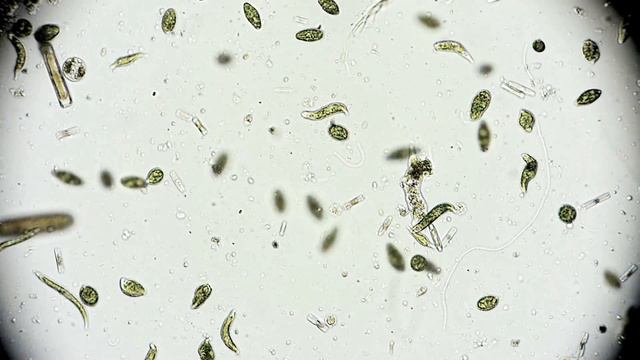 🔬 Amöbe - Wechseltierchen - Amoeba Limax - Microorganism Under Microscope - Leben Im Wassertropfen