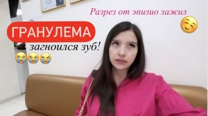РАЗРЕЗ ОТ ЭПИЗИОТОМИИ ЗАЖИЛ СПУСТЯ МЕСЯЦ БЕЗ ШВОВ!!! НО НАЧАЛОСЬ КОЕ ЧТО ПОХУЖЕ РАЗРЕЗА((
